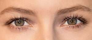 eyelashes transplant