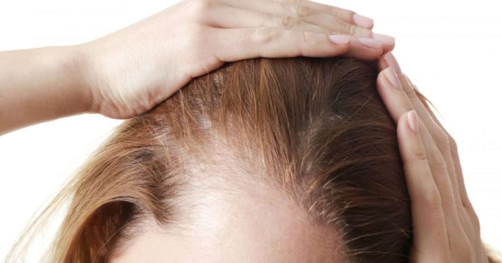 hair loss treatment in lahore, hair loss treatment in lPakistan
