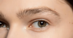 best eyebrow hair transplant